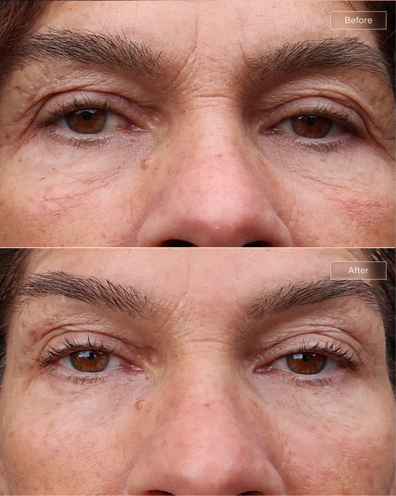 Customer result