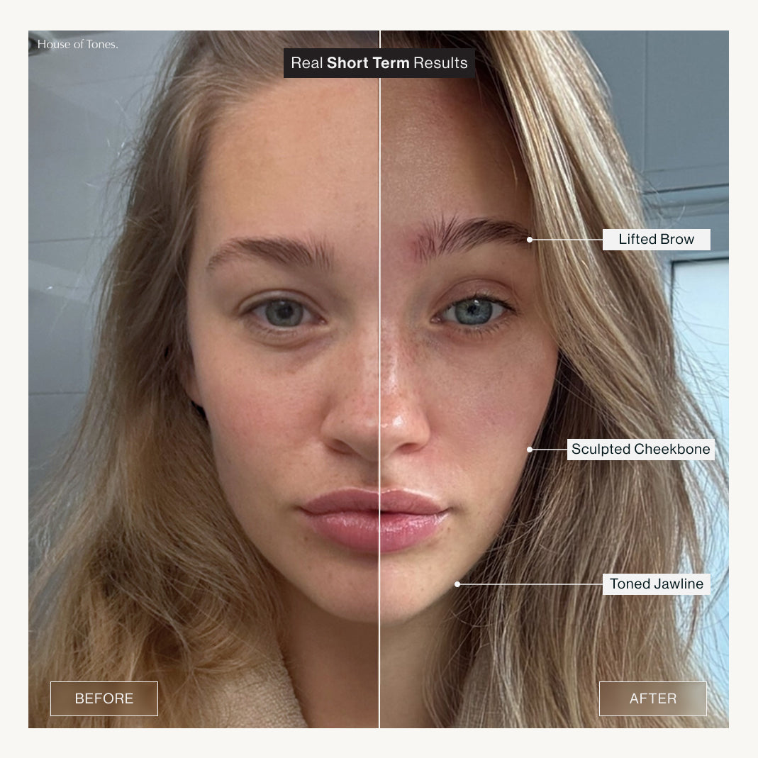 Elevate Essentials Kit