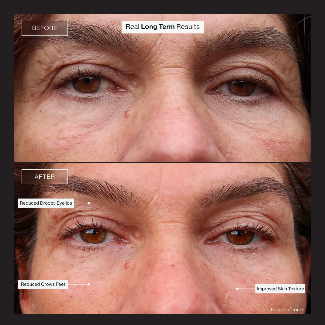 Elevate Essentials Kit