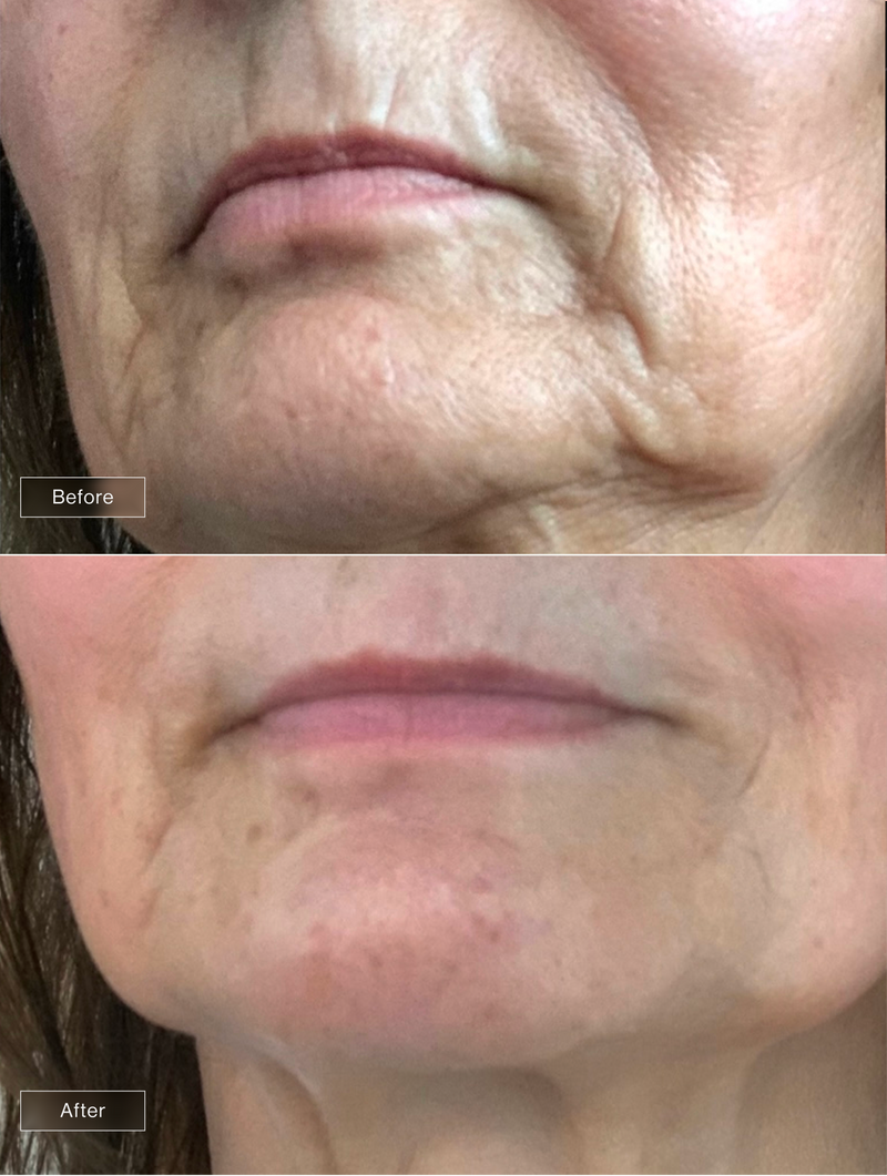 Customer result