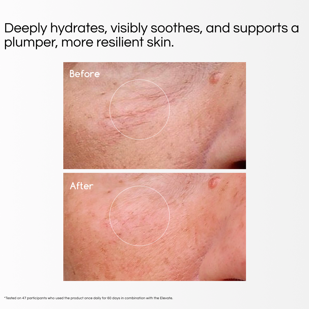 hydroglow activator gel