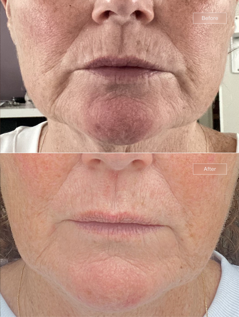 Customer result